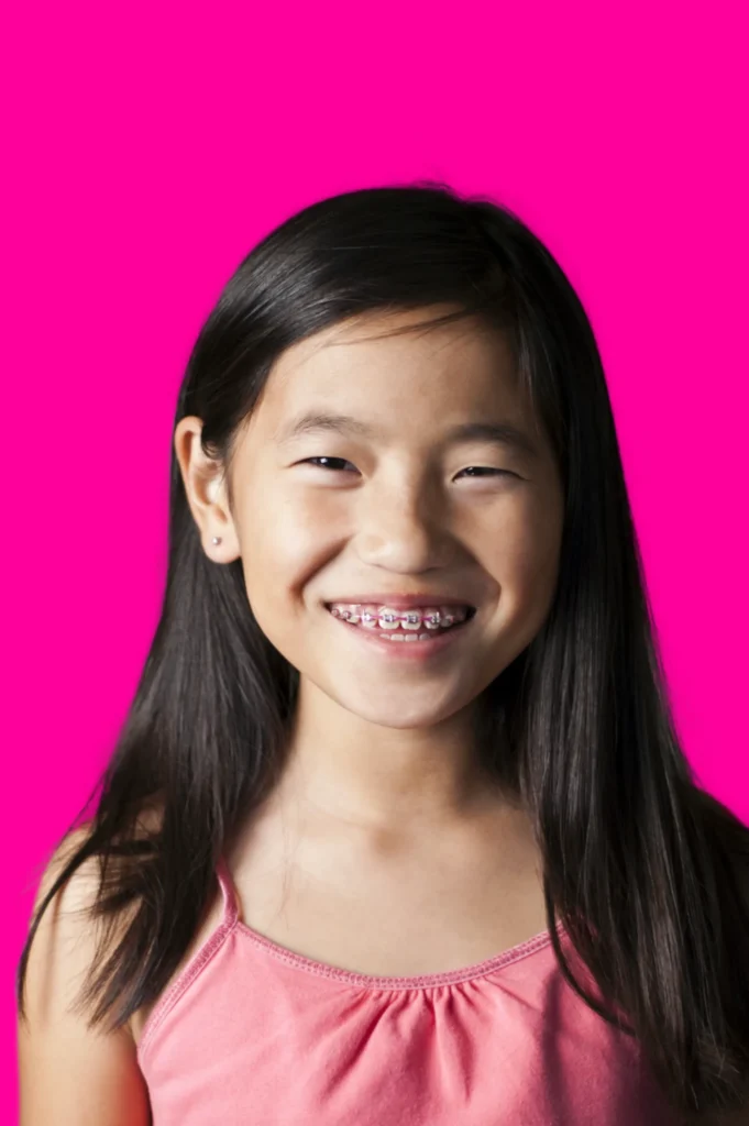 Early Orthodontic Treatment And How Does It Work