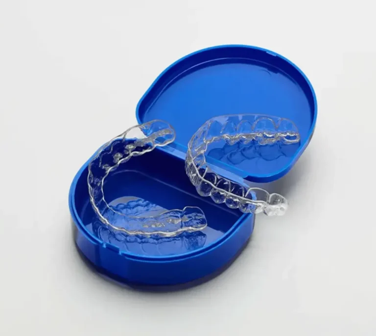 Retainers After Braces | Custom Orthodontic Retainers